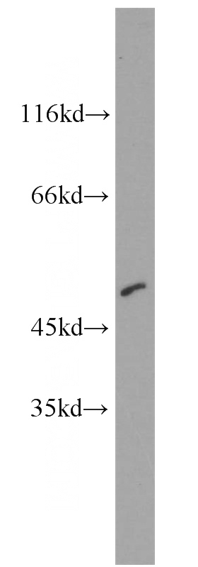 mouse heart tissue were subjected to SDS PAGE followed by western blot with Catalog No:109625(CTBP2 antibody) at dilution of 1:800
