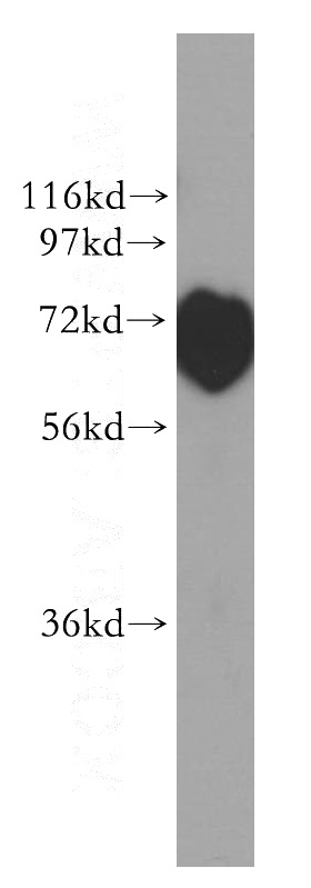 mouse testis tissue were subjected to SDS PAGE followed by western blot with Catalog No:109018(Cd2ap antibody) at dilution of 1:200