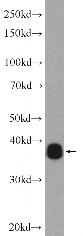 HeLa cells were subjected to SDS PAGE followed by western blot with Catalog No:113272(NRBF2 Antibody) at dilution of 1:1000