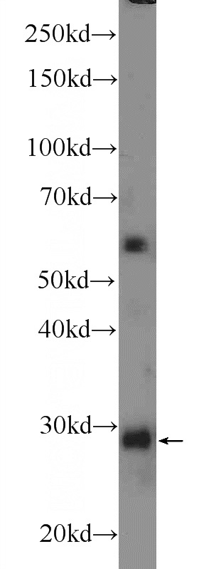 mouse heart tissue were subjected to SDS PAGE followed by western blot with Catalog No:116192(TMEM55B Antibody) at dilution of 1:300