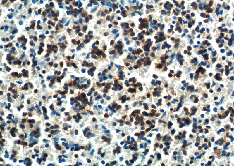 Immunohistochemistry of paraffin-embedded mouse spleen tissue slide using Catalog No:114322(PTPN5 Antibody) at dilution of 1:200 (under 40x lens).