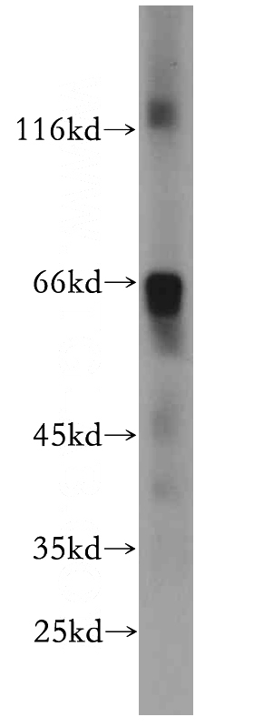 mouse liver tissue were subjected to SDS PAGE followed by western blot with Catalog No:116384(TTC39A antibody) at dilution of 1:100