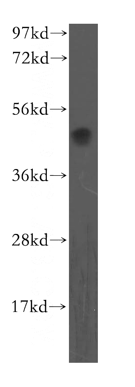 human liver tissue were subjected to SDS PAGE followed by western blot with Catalog No:113345(OLR1 antibody) at dilution of 1:500