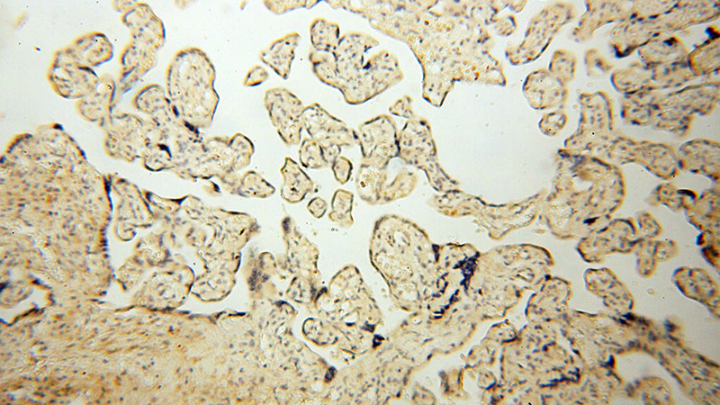 Immunohistochemical of paraffin-embedded human placenta using Catalog No:112708(MMP8 antibody) at dilution of 1:100 (under 10x lens)