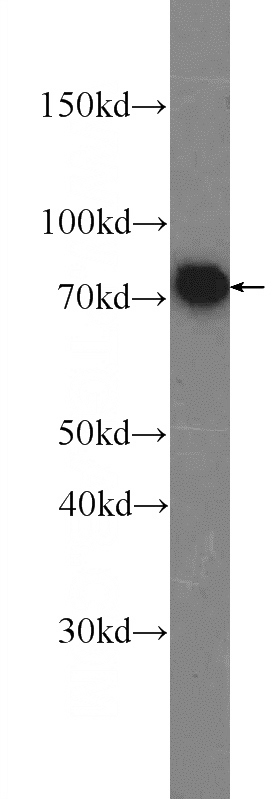 SGC-7901 cells were subjected to SDS PAGE followed by western blot with Catalog No:112726(MSN Antibody) at dilution of 1:2000