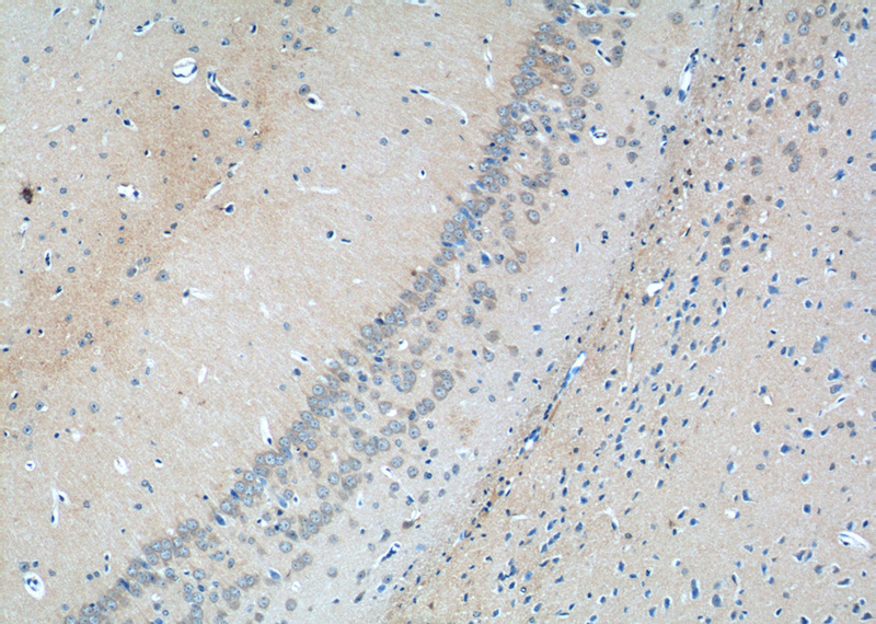 Immunohistochemistry of paraffin-embedded mouse brain tissue slide using Catalog No:111031(GLRA2 Antibody) at dilution of 1:50 (under 10x lens)
