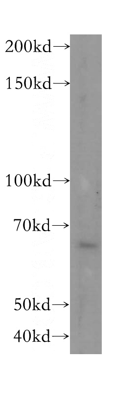 HepG2 cells were subjected to SDS PAGE followed by western blot with Catalog No:112514(METAP2 antibody) at dilution of 1:300