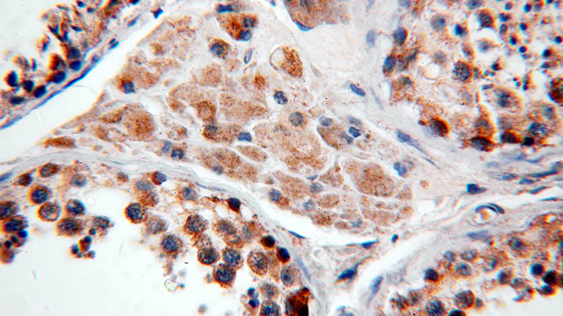 Immunohistochemical of paraffin-embedded human testis using Catalog No:116690(USP50 antibody) at dilution of 1:50 (under 40x lens)