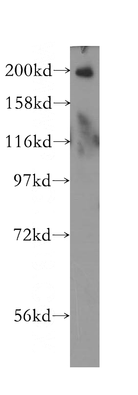 HEK-293 cells were subjected to SDS PAGE followed by western blot with Catalog No:114592(RBBP6 antibody) at dilution of 1:400