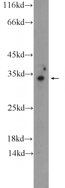 MCF-7 cells were subjected to SDS PAGE followed by western blot with Catalog No:113516(OTUD6A Antibody) at dilution of 1:1000