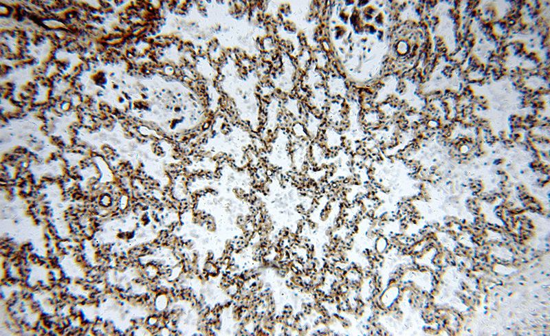 Immunohistochemical of paraffin-embedded human lung using Catalog No:115653(SPTBN1-Specific antibody) at dilution of 1:100 (under 10x lens)