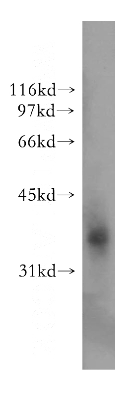 HeLa cells were subjected to SDS PAGE followed by western blot with Catalog No:110418(EXTL2 antibody) at dilution of 1:400