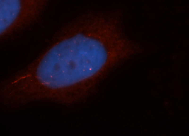 Immunofluorescent analysis of Hela cells, using PHKG2 antibody Catalog No:113822 at 1:25 dilution and Rhodamine-labeled goat anti-rabbit IgG (red). Blue pseudocolor = DAPI (fluorescent DNA dye).
