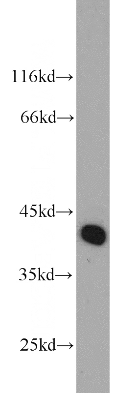 mouse skeletal muscle tissue were subjected to SDS PAGE followed by western blot with Catalog No:112439(MAPKAP1 antibody) at dilution of 1:1000