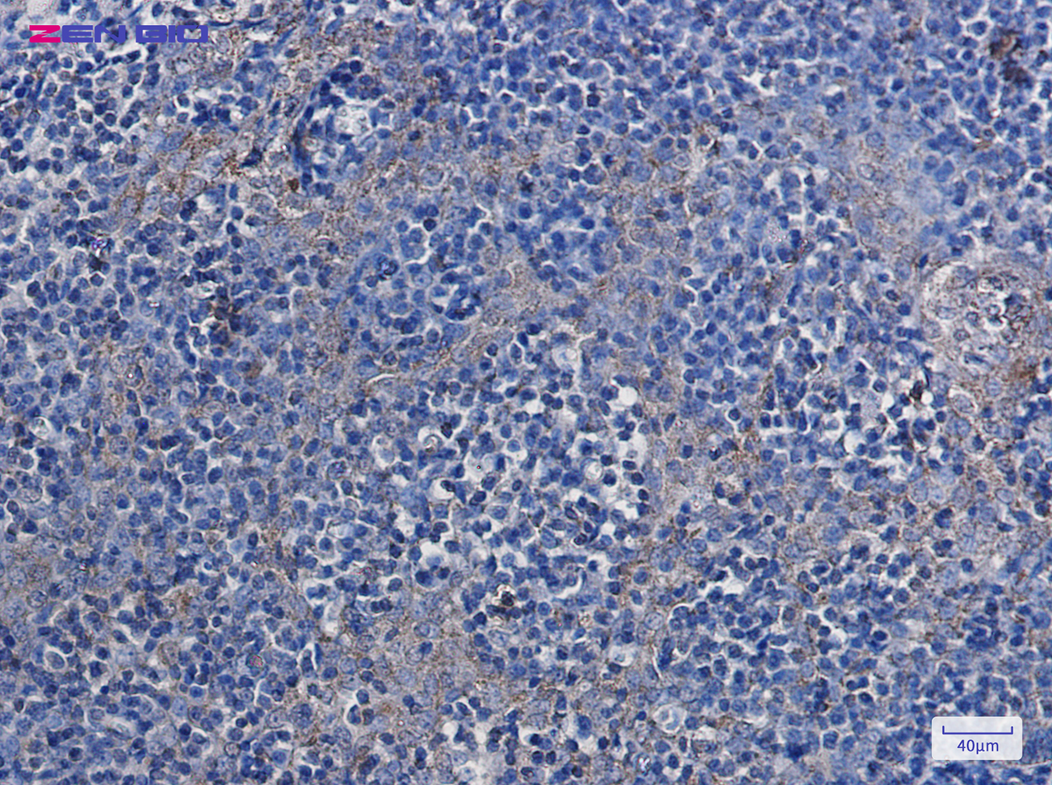 Immunohistochemistry of Hexokinase 1 in paraffin-embedded Human tonsil using Hexokinase 1 Rabbit pAb at dilution 1/20
