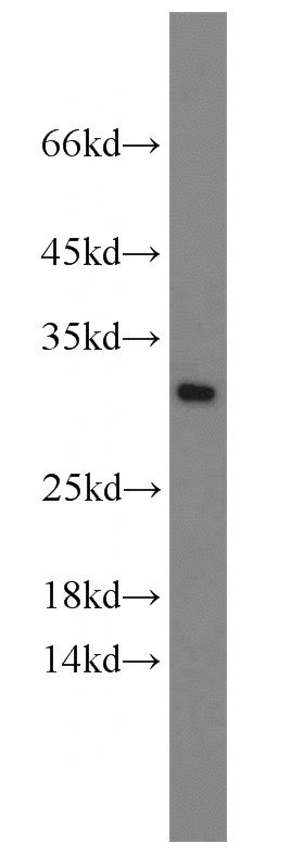 COLO 320 cells were subjected to SDS PAGE followed by western blot with Catalog No:110270(EIF6 antibody) at dilution of 1:1000
