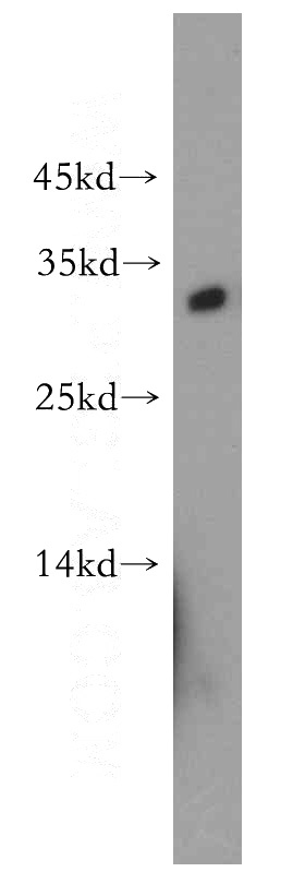 mouse skeletal muscle tissue were subjected to SDS PAGE followed by western blot with Catalog No:109983(DKK2 antibody) at dilution of 1:300