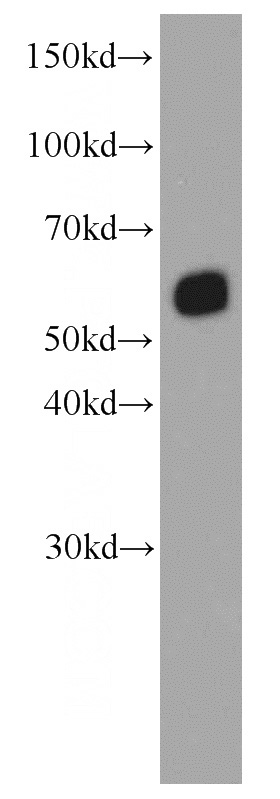 Jurkat cells were subjected to SDS PAGE followed by western blot with Catalog No:107589(SMARCD1 antibody) at dilution of 1:1000