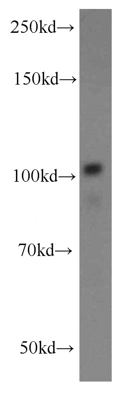 mouse spleen tissue were subjected to SDS PAGE followed by western blot with Catalog No:108318(ATP9A antibody) at dilution of 1:300