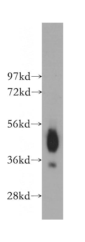 human liver tissue were subjected to SDS PAGE followed by western blot with Catalog No:109055(CD147 antibody) at dilution of 1:500