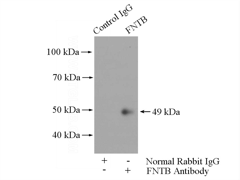 IP Result of anti-FNTB (IP:Catalog No:110741, 4ug; Detection:Catalog No:110741 1:1000) with HeLa cells lysate 800ug.
