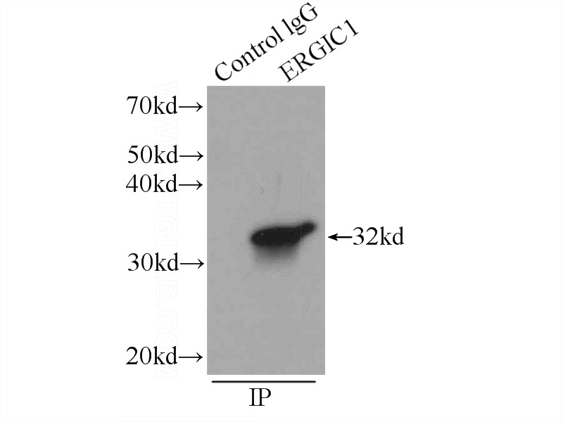 IP Result of anti-ERGIC1 (IP:Catalog No:110356, 3ug; Detection:Catalog No:110356 1:500) with HepG2 cells lysate 1720ug.
