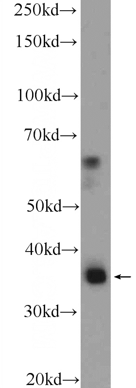 RAW 264.7 cells were subjected to SDS PAGE followed by western blot with Catalog No:109246(CEBPB Antibody) at dilution of 1:300