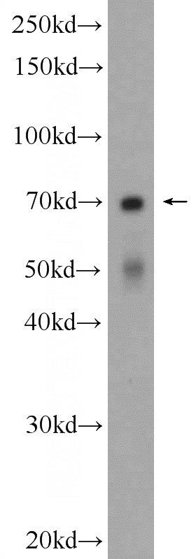 K-562 cells were subjected to SDS PAGE followed by western blot with Catalog No:110331(ENTPD2 Antibody) at dilution of 1:600