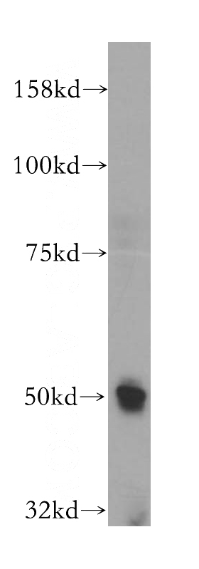 SH-SY5Y cells were subjected to SDS PAGE followed by western blot with Catalog No:113236(NR2C1 antibody) at dilution of 1:500