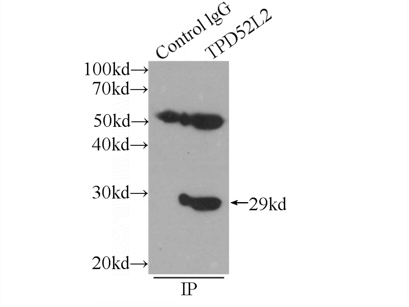 IP Result of anti-TPD52L2 (IP:Catalog No:116262, 3ug; Detection:Catalog No:116262 1:800) with HEK-293 cells lysate 2400ug.
