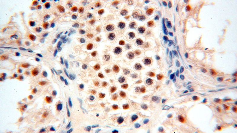 Immunohistochemical of paraffin-embedded human testis using Catalog No:110407(ERCC1 antibody) at dilution of 1:50 (under 40x lens)