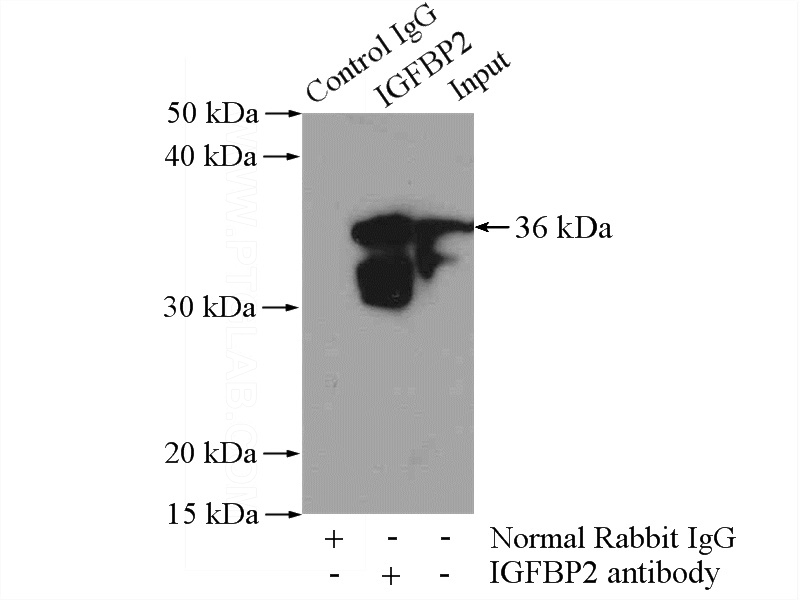 IP Result of anti-IGFBP2 (IP:Catalog No:111685, 4ug; Detection:Catalog No:111685 1:300) with SH-SY5Y cells lysate 1200ug.