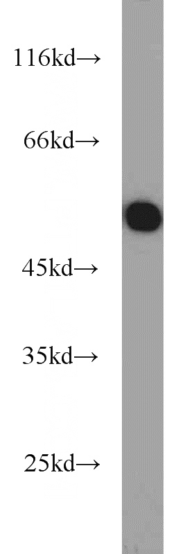mouse lung tissue were subjected to SDS PAGE followed by western blot with Catalog No:107966(ALDH2 antibody) at dilution of 1:1000
