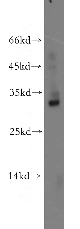 mouse brain tissue were subjected to SDS PAGE followed by western blot with Catalog No:117150(BIRC8 antibody) at dilution of 1:200
