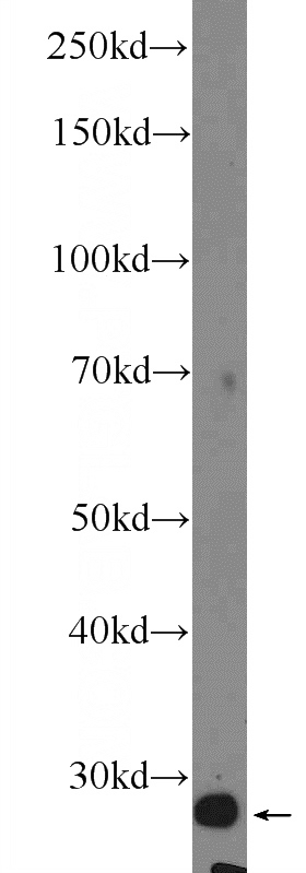 mouse kidney tissue were subjected to SDS PAGE followed by western blot with Catalog No:109390(CLIC4 Antibody) at dilution of 1:600