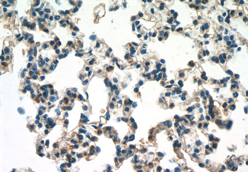 Immunohistochemistry of paraffin-embedded mouse lung tissue slide using Catalog No:110428(F2RL3 Antibody) at dilution of 1:50 (under 40x lens)