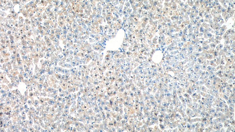 Immunohistochemistry of paraffin-embedded mouse liver tissue slide using Catalog No:117162(ZNF326 Antibody) at dilution of 1:100 (under 10x lens).