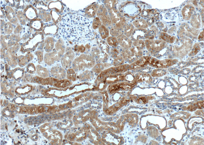 Immunohistochemistry of paraffin-embedded human kidney tissue slide using Catalog No:113308(NOTCH1 Antibody) at dilution of 1:200 (under 10x lens).