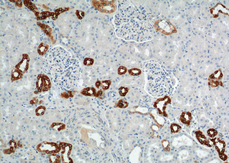 Immunohistochemistry of paraffin-embedded human kidney tissue slide using Catalog No:111140(GPRC5D Antibody) at dilution of 1:100 (under 10x lens).