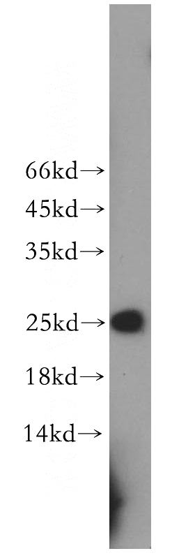 mouse thymus tissue were subjected to SDS PAGE followed by western blot with Catalog No:114801(RPE antibody) at dilution of 1:200
