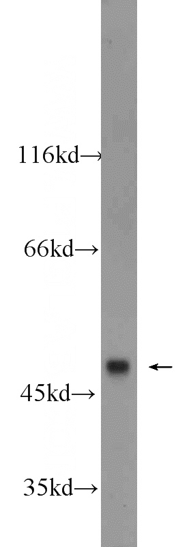 HEK-293 cells were subjected to SDS PAGE followed by western blot with Catalog No:117194(BMP10 antibody) at dilution of 1:600