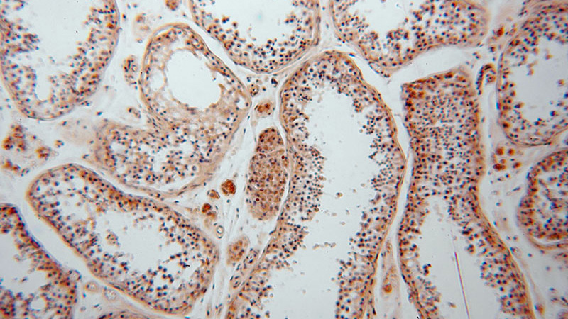 Immunohistochemical of paraffin-embedded human testis using Catalog No:107963(ALDH1B1 antibody) at dilution of 1:100 (under 10x lens)