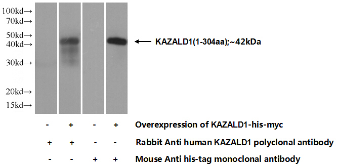Transfected HEK-293 cells were subjected to SDS PAGE followed by western blot with Catalog No:111917(KAZALD1 Antibody) at dilution of 1:1000
