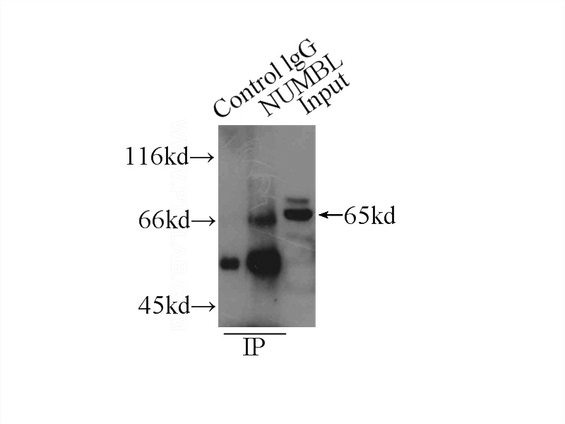 IP Result of anti-NUMBLIKE (IP:Catalog No:113372, 3ug; Detection:Catalog No:113372 1:1000) with HeLa cells lysate 1000ug.