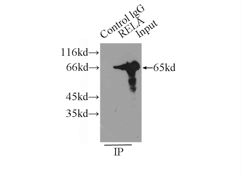 IP Result of anti-p65 (IP:Catalog No:113559, 3ug; Detection:Catalog No:113559 1:1000) with HeLa cells lysate 5000ug.