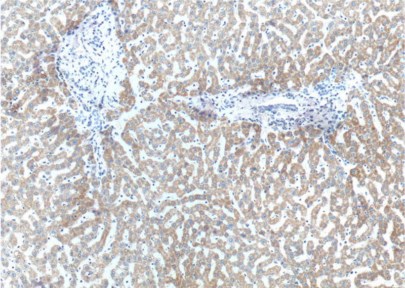 Immunohistochemistry of paraffin-embedded human liver tissue slide using Catalog No:110737(FNDC3B Antibody) at dilution of 1:200 (under 10x lens).