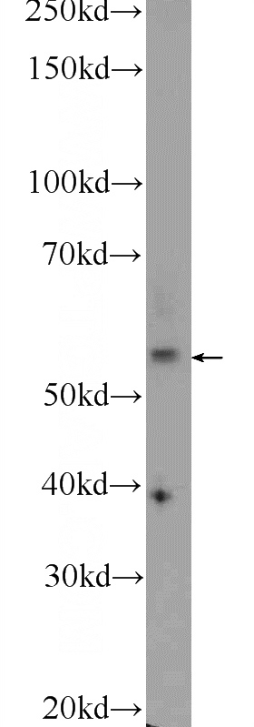 human plasma tissue were subjected to SDS PAGE followed by western blot with Catalog No:113177(NHEDC2 Antibody) at dilution of 1:600