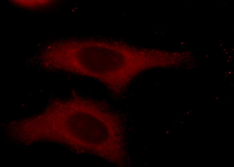 Immunofluorescent analysis of HepG2 cells using Catalog No:117300(tubulin-Alpha Antibody) at dilution of 1:25 and Rhodamine-Goat anti-Rabbit IgG