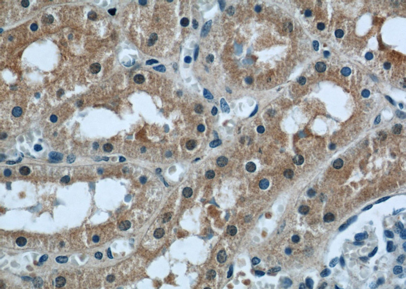 Immunohistochemical of paraffin-embedded human kidney using Catalog No:114097(PPP2R1A antibody) at dilution of 1:50 (under 40x lens)
