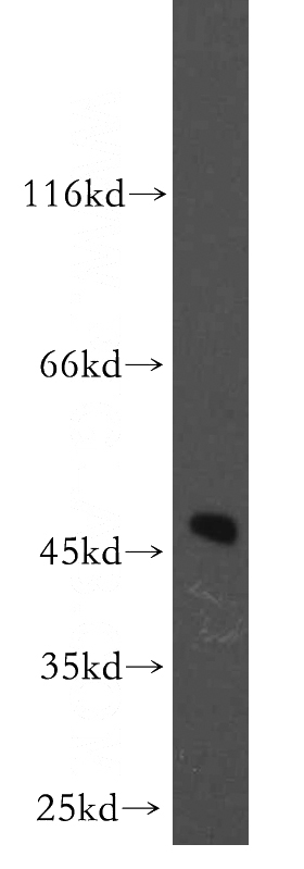 human brain tissue were subjected to SDS PAGE followed by western blot with Catalog No:108125(AP3M2 antibody) at dilution of 1:200